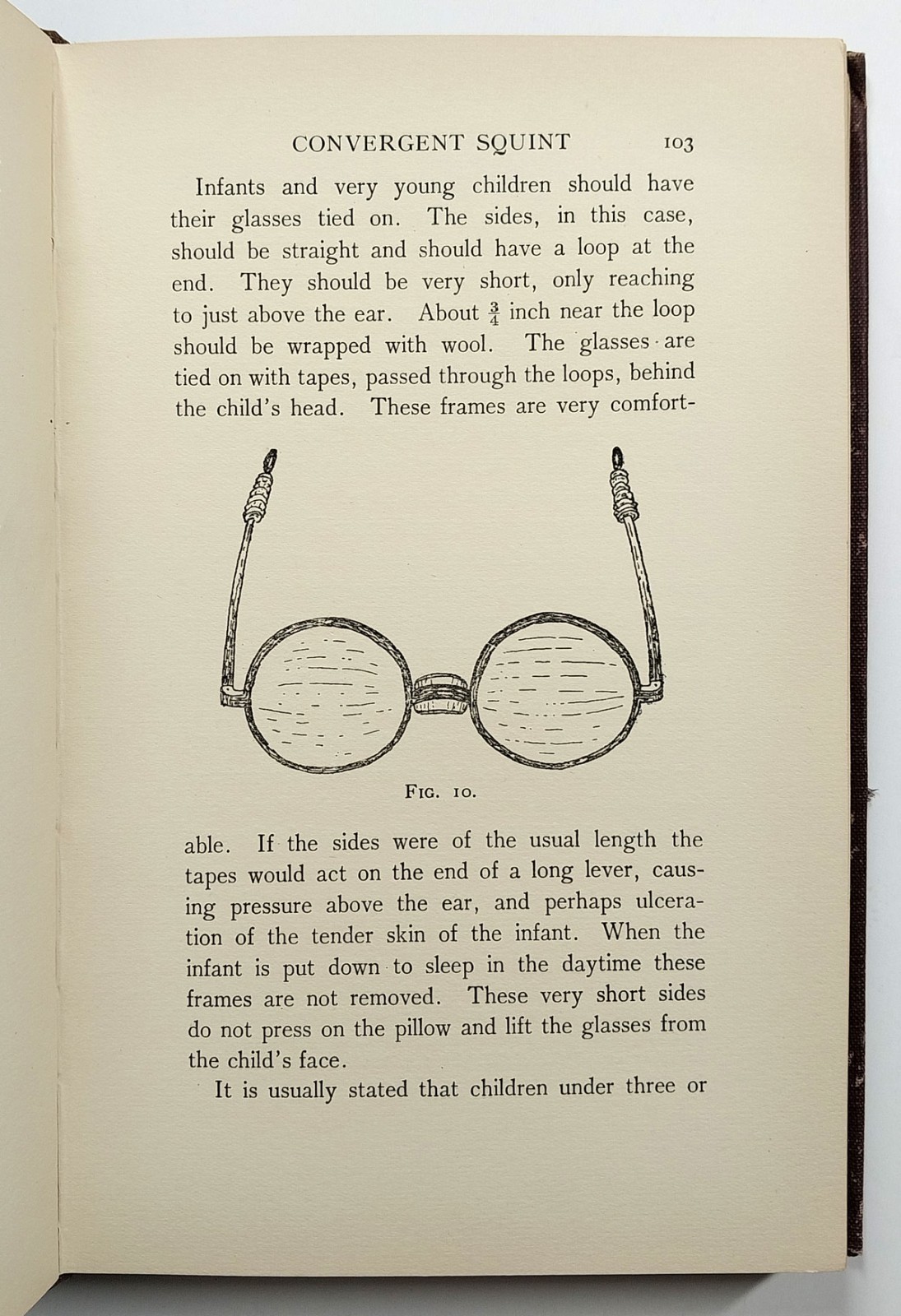 Squint Its Causes Pathology And Treatment Claud Worth Optometry 5th Edition 1921