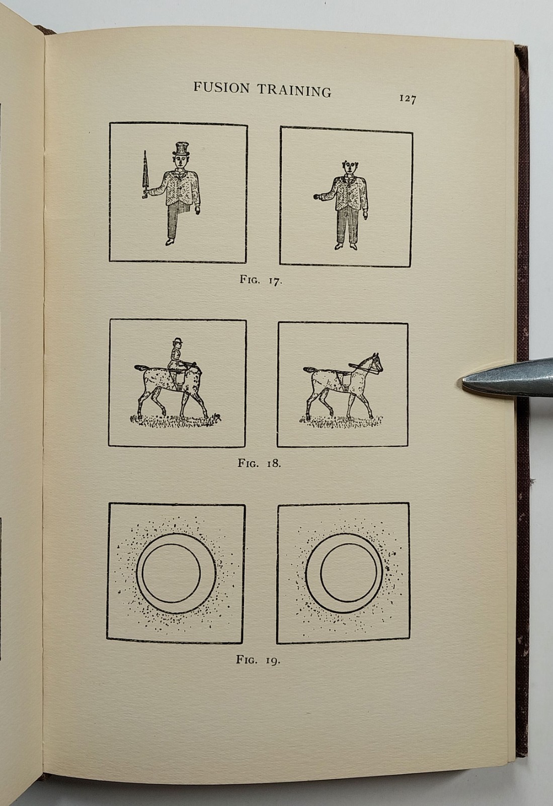 Squint Its Causes Pathology And Treatment Claud Worth Optometry 5th Edition 1921