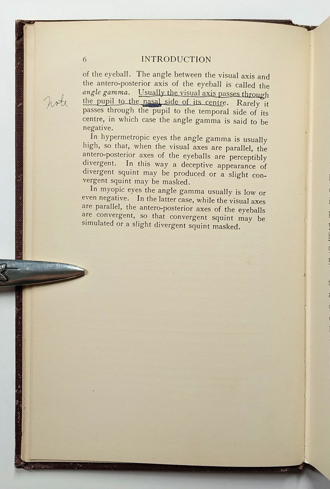Squint Its Causes Pathology And Treatment Claud Worth Optometry 5th Edition 1921