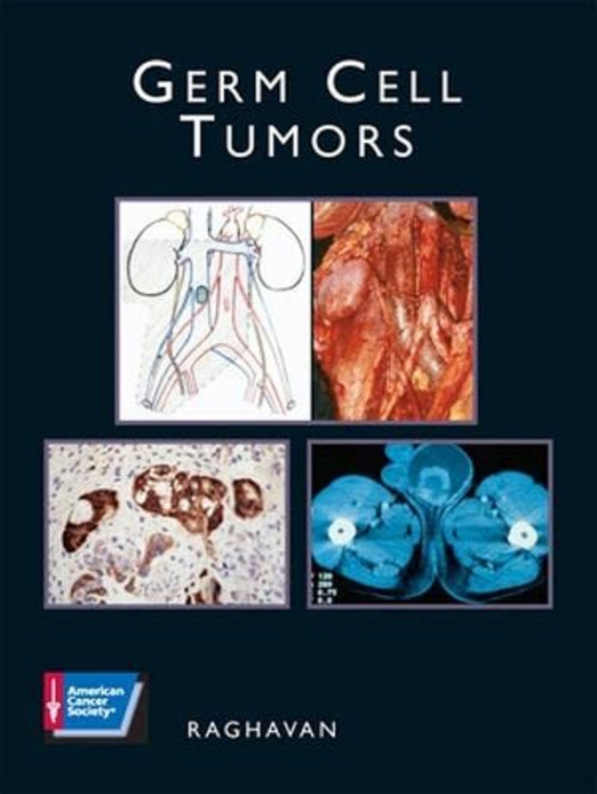 BRAND NEW: Germ Cell Tumors: American Cancer Society Atlas of Clinical Oncology