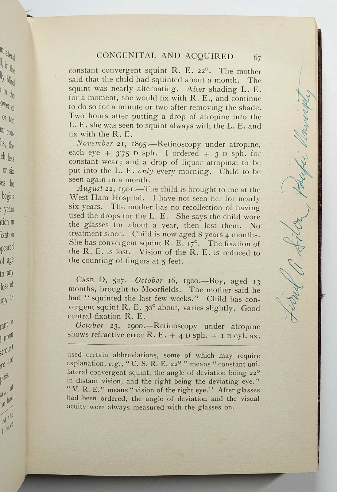 Squint Its Causes Pathology And Treatment Claud Worth Optometry 5th Edition 1921
